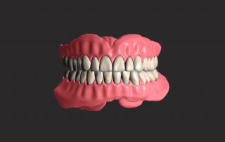 Prosthodontic