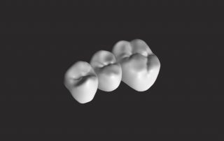 Prosthodontic