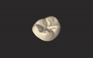 Prosthodontic