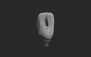 Prosthodontic