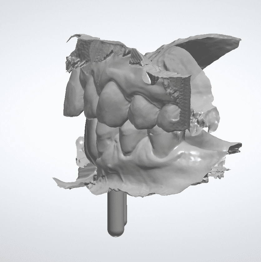 Dentinova-Bridge-on-implants-Design