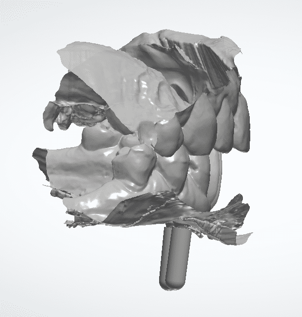 Dentinova-Bridge-on-implants-Design
