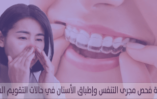 أهمية فحص مجرى التنفس وإطباق الأسنان في حالات التقويم الشفاف