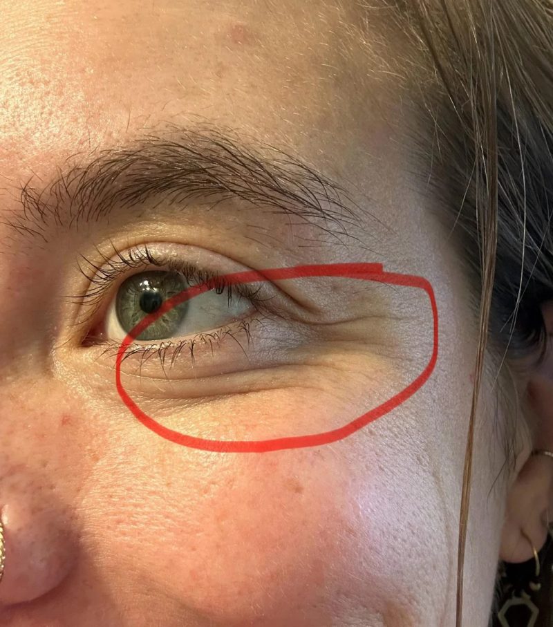 التجعدات حول العينين دلالة على الابتسامة العفوية