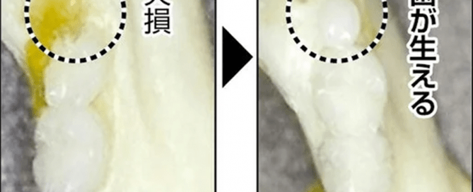 A Breakthrough in Teeth Regeneration: First Human Trials Begin This Month