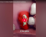 Dental Anesthesia The Truth About Fear of Broken Needles
