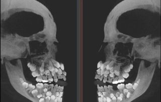 dr katsu takahashi third set of teeth