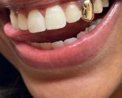 gold tooth, gold grillz, gold crown