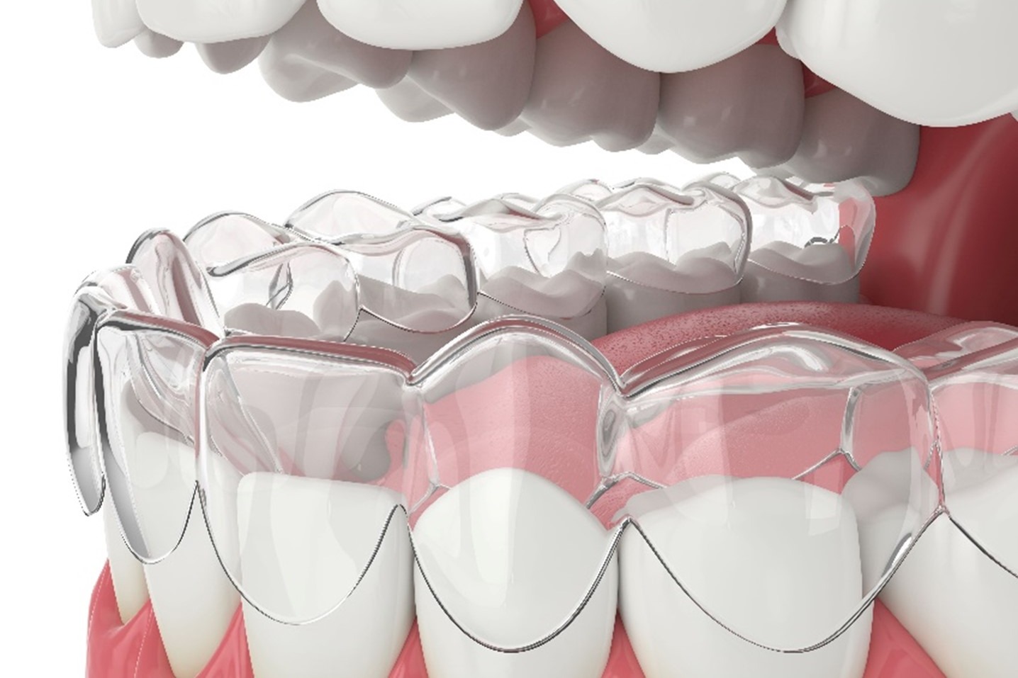 Basic Clear Aligner Course