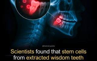 Stem Cells from Wisdom Teeth Could Revolutionize Medicine