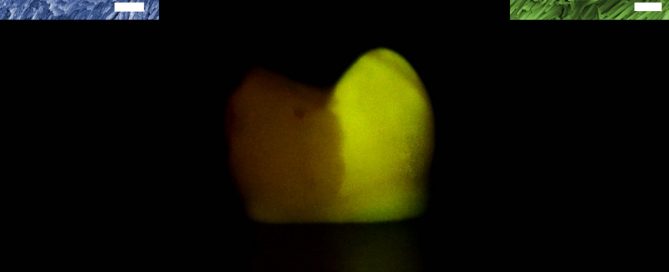 Tang and Shao Discovery in Regenerative Dentistry