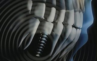 Woman's Hearing Restored By Routine Dental Implant Surgery