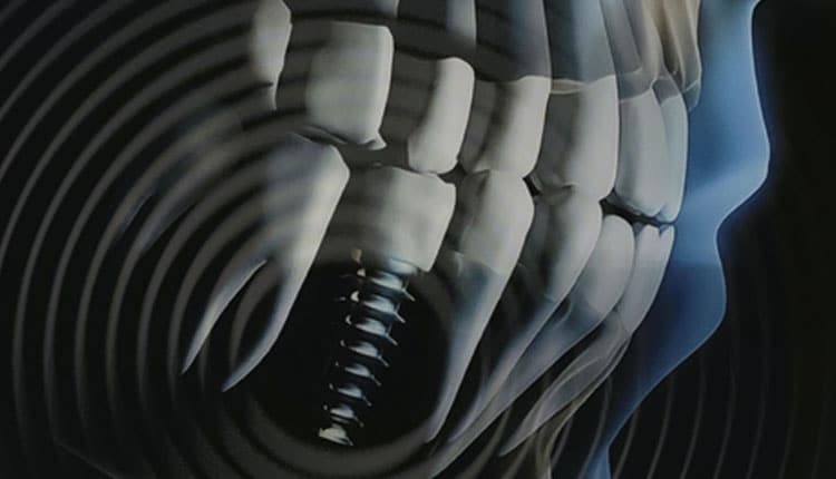 Woman's Hearing Restored By Routine Dental Implant Surgery