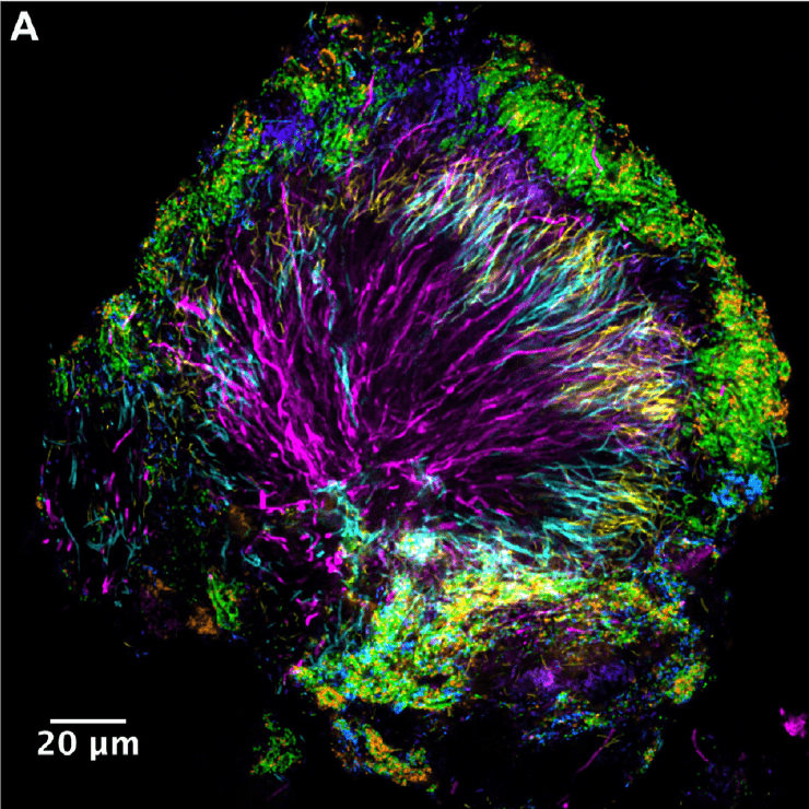 Not All Dental Plaque is Evil Some Bacteria Might Be Your Mouth’s Best Friends!