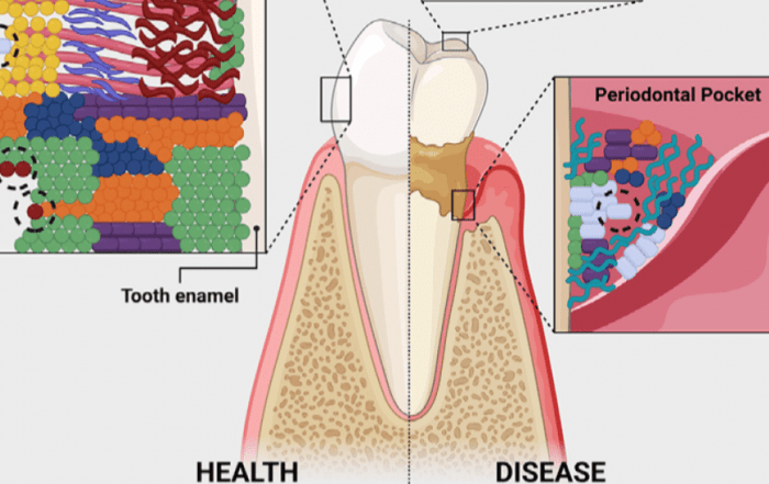 Not All Dental Plaque is Evil Some Bacteria Might Be Your Mouth’s Best Friends!