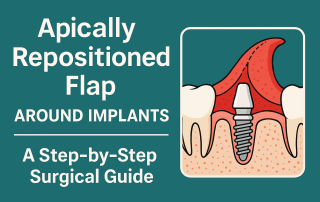 Apically Repositioned Flap Around Implants