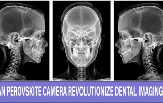 Perovskite-Camera-for-dental-imaging
