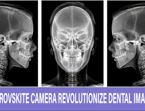 Perovskite Camera Revolutionizes Dental Imaging