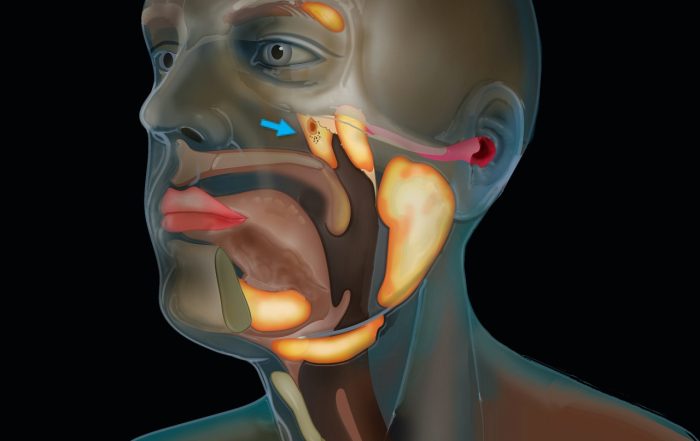 Tubarial Glands The Nasopharynx Hidden Salivary Glands