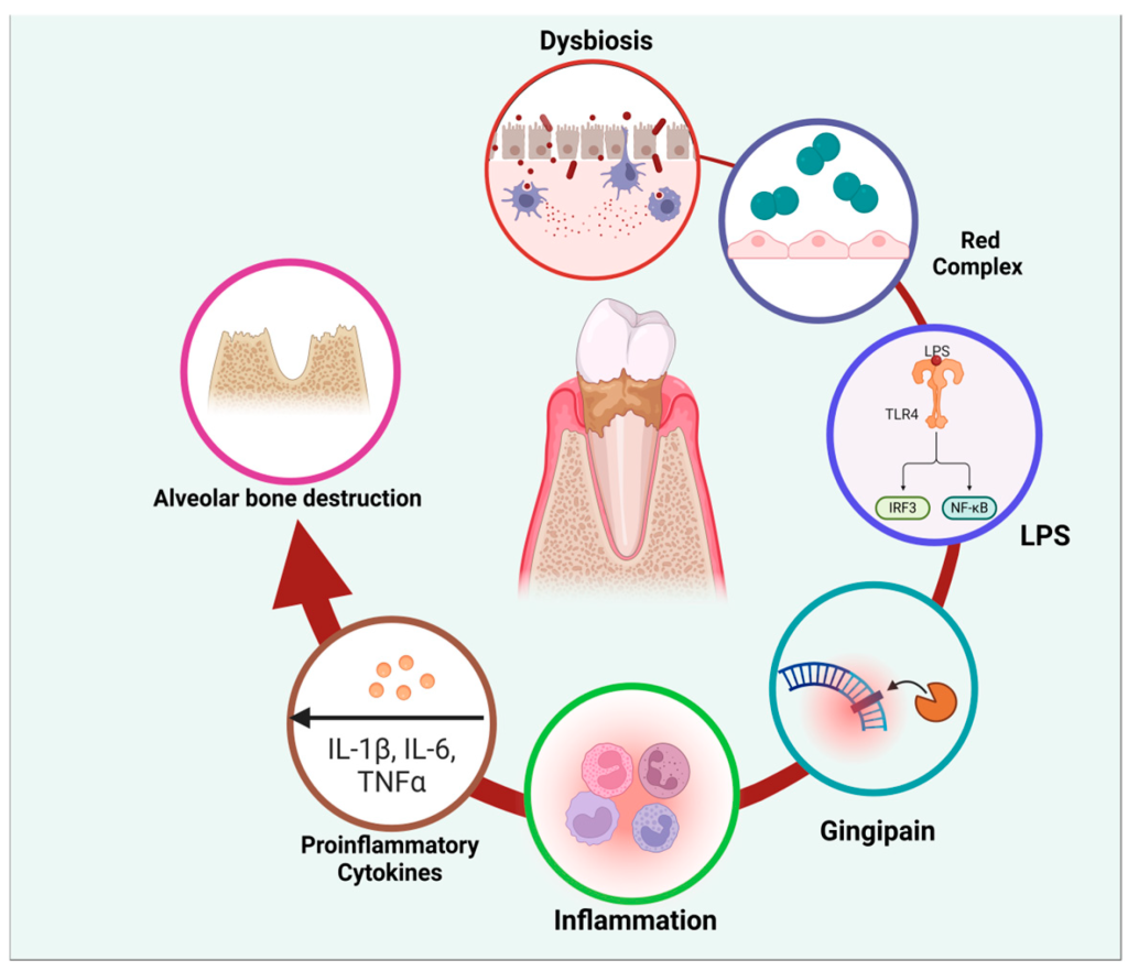 Pathophysiological cycle of periodontitis