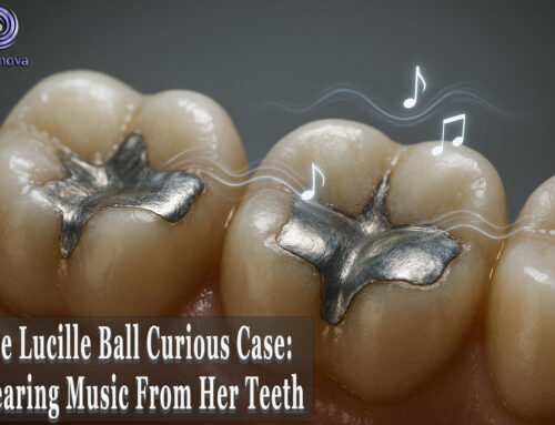 The Lucille Ball Curious Case: Hearing Music From Her Teeth