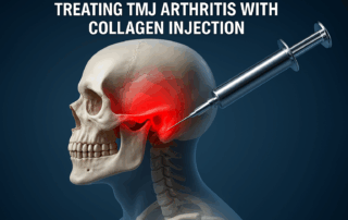 Treating TMJ Arthritis with Collagen Injection