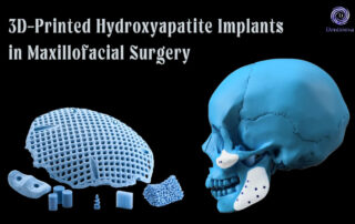 3D-Printed Hydroxyapatite Implants in Maxillofacial Surgery