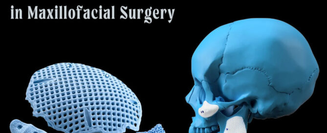 3D-Printed Hydroxyapatite Implants in Maxillofacial Surgery