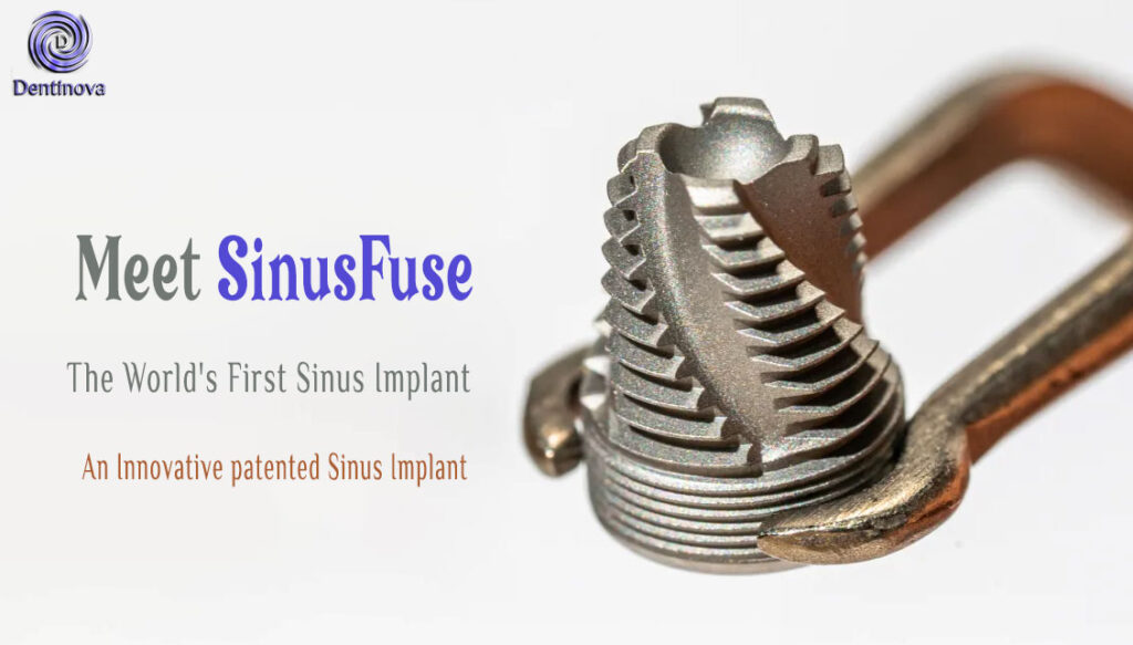 Meet SinusFuse: The World’s First Sinus Implant