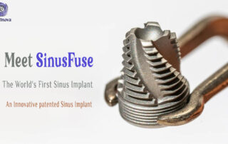 Meet SinusFuse: The World’s First Sinus Implant