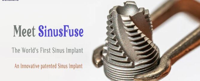 Meet SinusFuse: The World’s First Sinus Implant