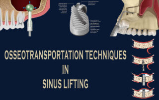 Osseotransportation Techniques in Sinus Lifting
