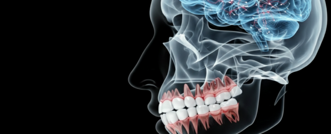 Periodontal Disease and Brain Aging: A New Study