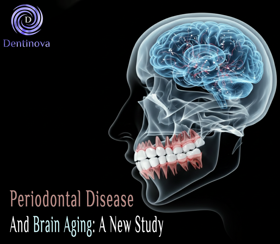 Periodontal Disease and Brain Aging: A New Study