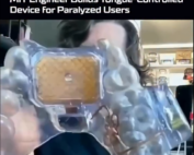 The MouthPad, A Tongue‑Controlled Device For Paralyzed Users