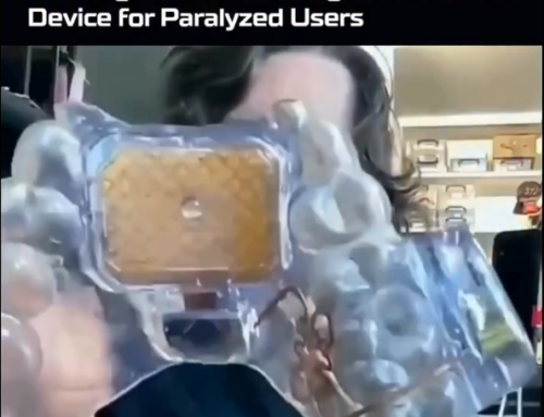 The MouthPad, A Tongue‑Controlled Device For Paralyzed Users