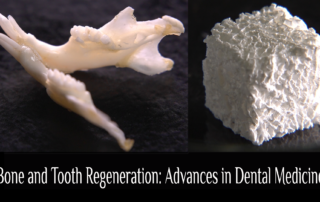 Bone and Tooth Regeneration: Advances in Dental Medicine