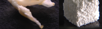 Bone and Tooth Regeneration: Advances in Dental Medicine