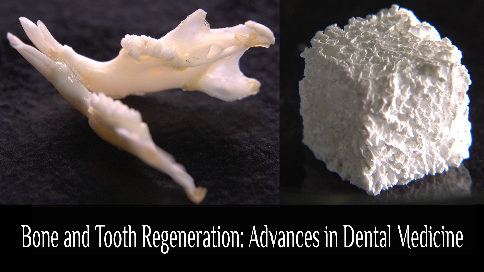 Bone and Tooth Regeneration: Advances in Dental Medicine