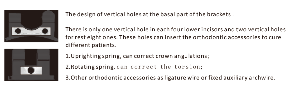 Light-force Low Friction Brackets A Patented Brackets Series