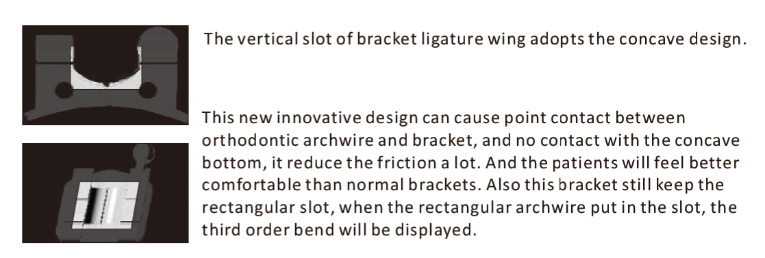 Light-force Low Friction Brackets A Patented Brackets Series