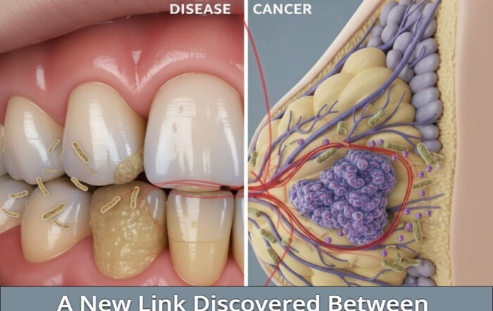 A Link Discovered Between Periodontal Disease and Breast Cancer