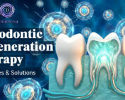 Endodontic Regeneration Therapy, Strategies & Solutions