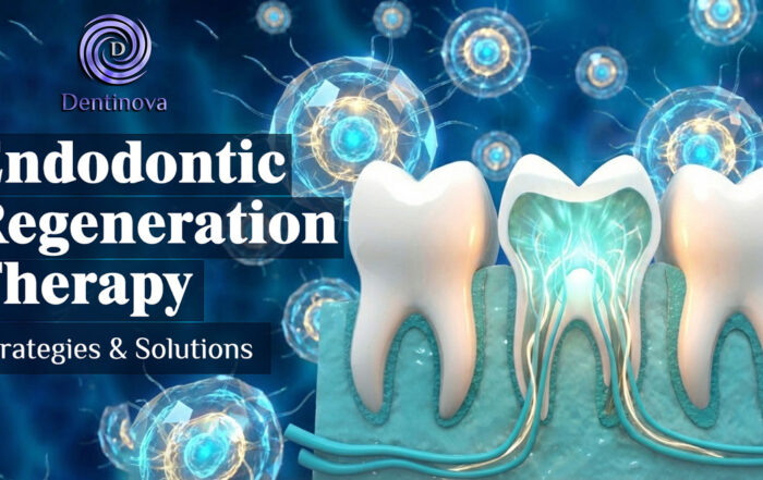 Endodontic Regeneration Therapy, Strategies & Solutions