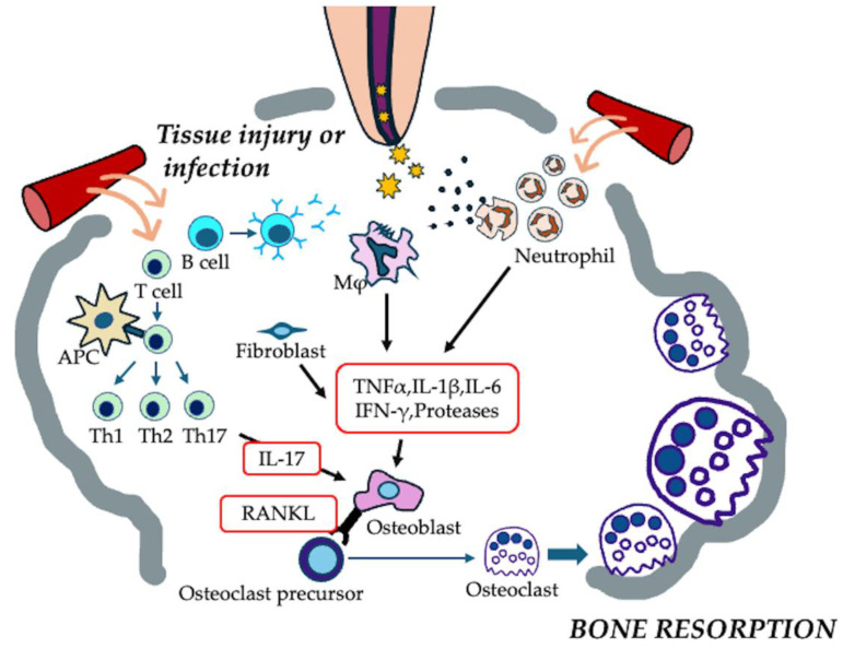 Endodontic Regeneration Therapy Strategies & Solutions
