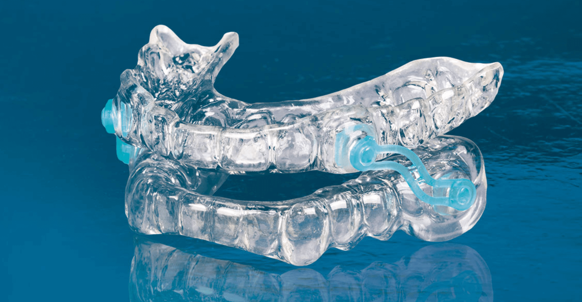 Snore Guard ( Silencer ) Fabrication For Sleep Apnea