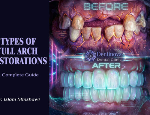 Types of Full Arch Restoration: A Complete Guide