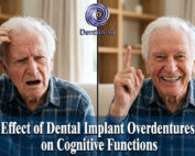 Effect of Dental Implant Overdentures on Cognitive Functions