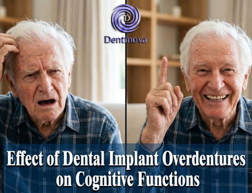 Effect of Dental Implant Overdentures on Cognitive Functions