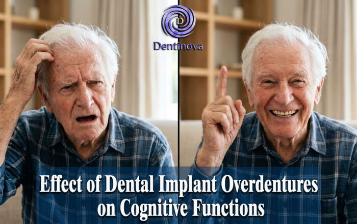 Effect of Dental Implant Overdentures on Cognitive Functions